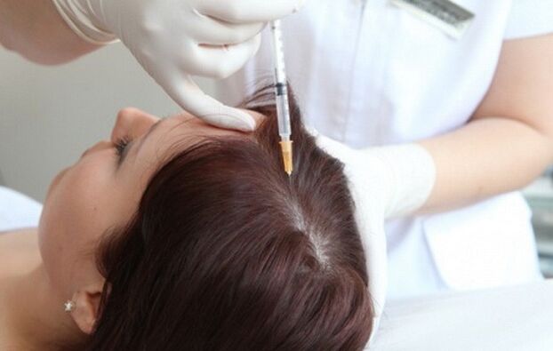 Mesoterapia no tratamento da alopecia feminina