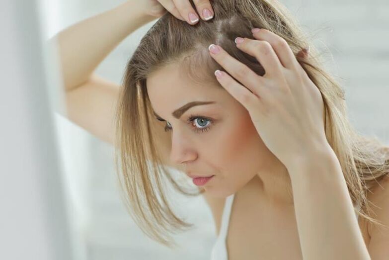 Unha nena examina focos de alopecia