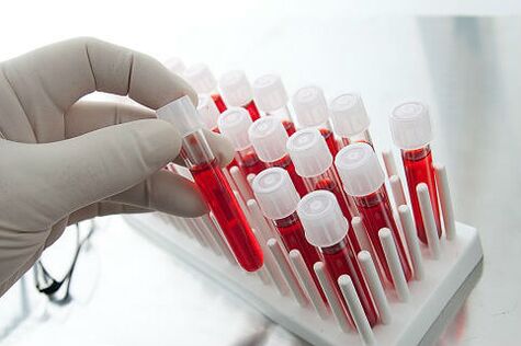 Análise de sangue para prescribir tratamento individual para a alopecia